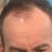 ONeillsForehead