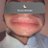 kpuuchon_