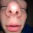 ExposeMayz